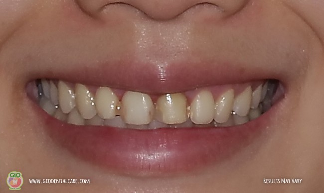 get-your-smile-here--1