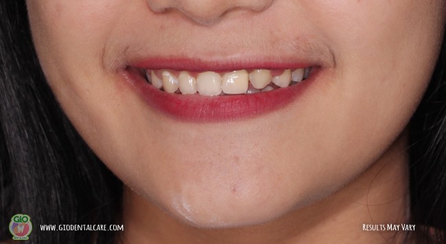 get-your-smile-here--1
