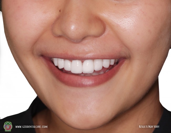 get-your-smile-here--1