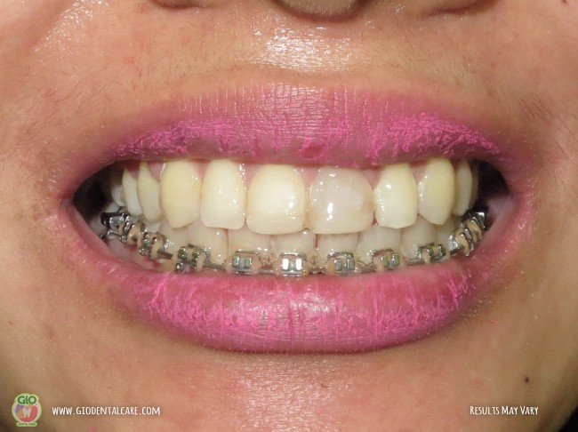 get-your-smile-here--1