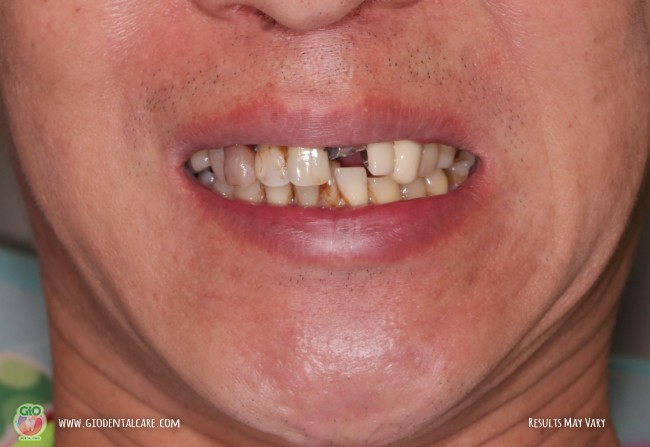 get-your-smile-here