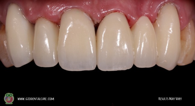 get-your-smile-here