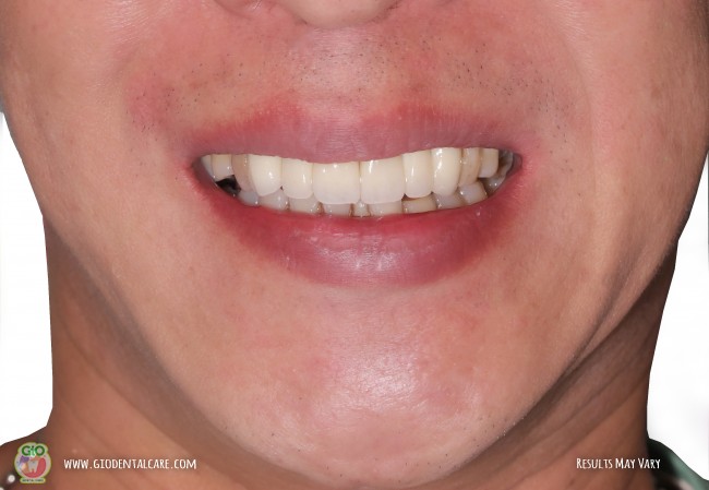 get-your-smile-here