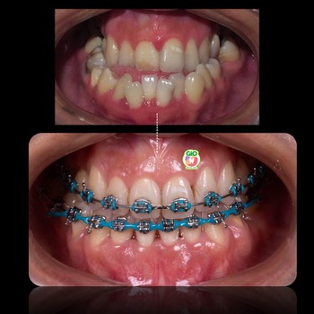 GiO Orthodontics