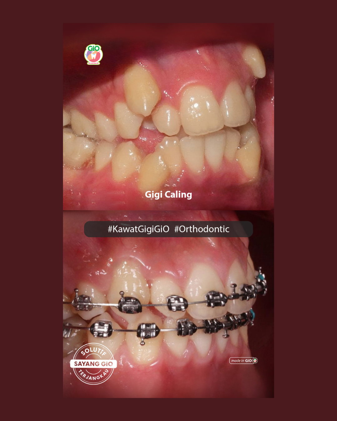 gio-orthodontic